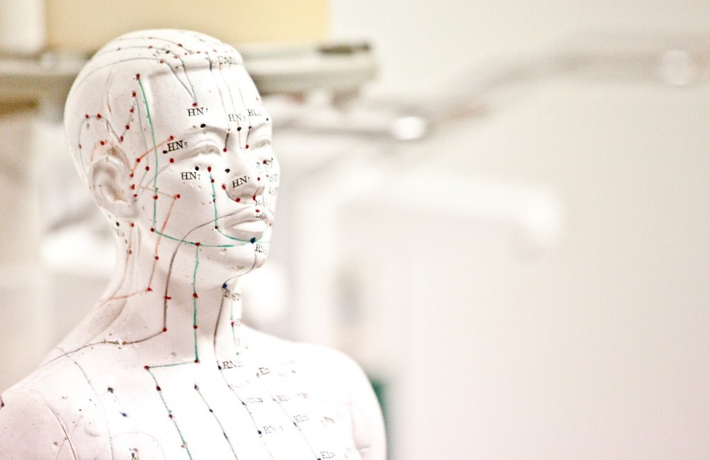 akupunktur-massage-radfloff-apm